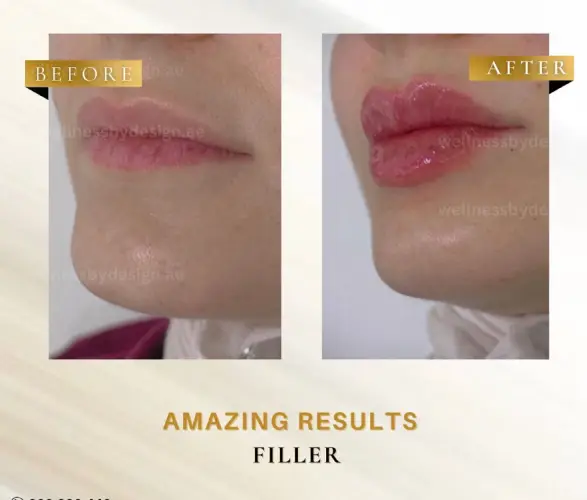 WhatsApp Image 2026-03-24 at 9.41.37 PM (1)