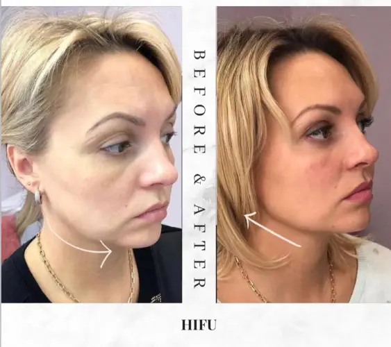 WhatsApp Image 2026-03-24 at 9.41.37 PM (2)