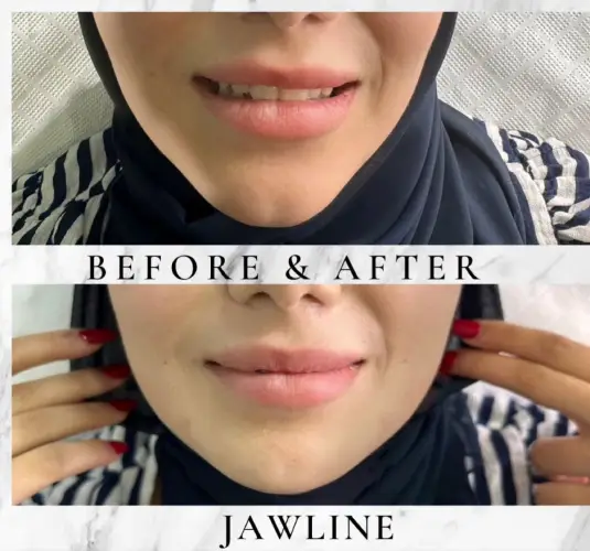 WhatsApp Image 2026-03-24 at 9.41.38 PM (2)